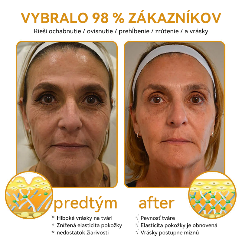 【🏅𝐎𝐟𝐢𝐜𝐢á𝐥𝐧𝐲 𝐨𝐛𝐜𝐡𝐨𝐝🏅】𝐃𝐨𝐫𝐦𝐨𝗿𝗻𝗮® 𝐁𝐨𝐭𝐨𝐱 𝐕č𝐞𝐥í 𝐉𝐞𝐝 𝐏𝐫𝐨𝐭𝐢 𝐕𝐫á𝐬𝐤𝐚𝐦 𝐊𝐫é𝐦 -✨𝑰𝒅𝒆á𝒍𝒏𝒆 𝒏𝒂 𝒔𝒑𝒆𝒗𝒏𝒆𝒏𝒊𝒆 𝒑𝒍𝒆𝒕𝒊, 𝒓𝒆𝒅𝒖𝒌𝒄𝒊𝒖 𝒗𝒓á𝒔𝒐𝒌 𝒐𝒌𝒐𝒍𝒐 𝒐čí, 𝒉ĺ𝒃𝒌𝒐𝒗ú 𝒉𝒚𝒅𝒓𝒂𝒕á𝒄𝒊𝒖 𝒂 𝒓𝒆𝒈𝒆𝒏𝒆𝒓á𝒄𝒊𝒖 𝒑𝒍𝒆𝒕𝒊.