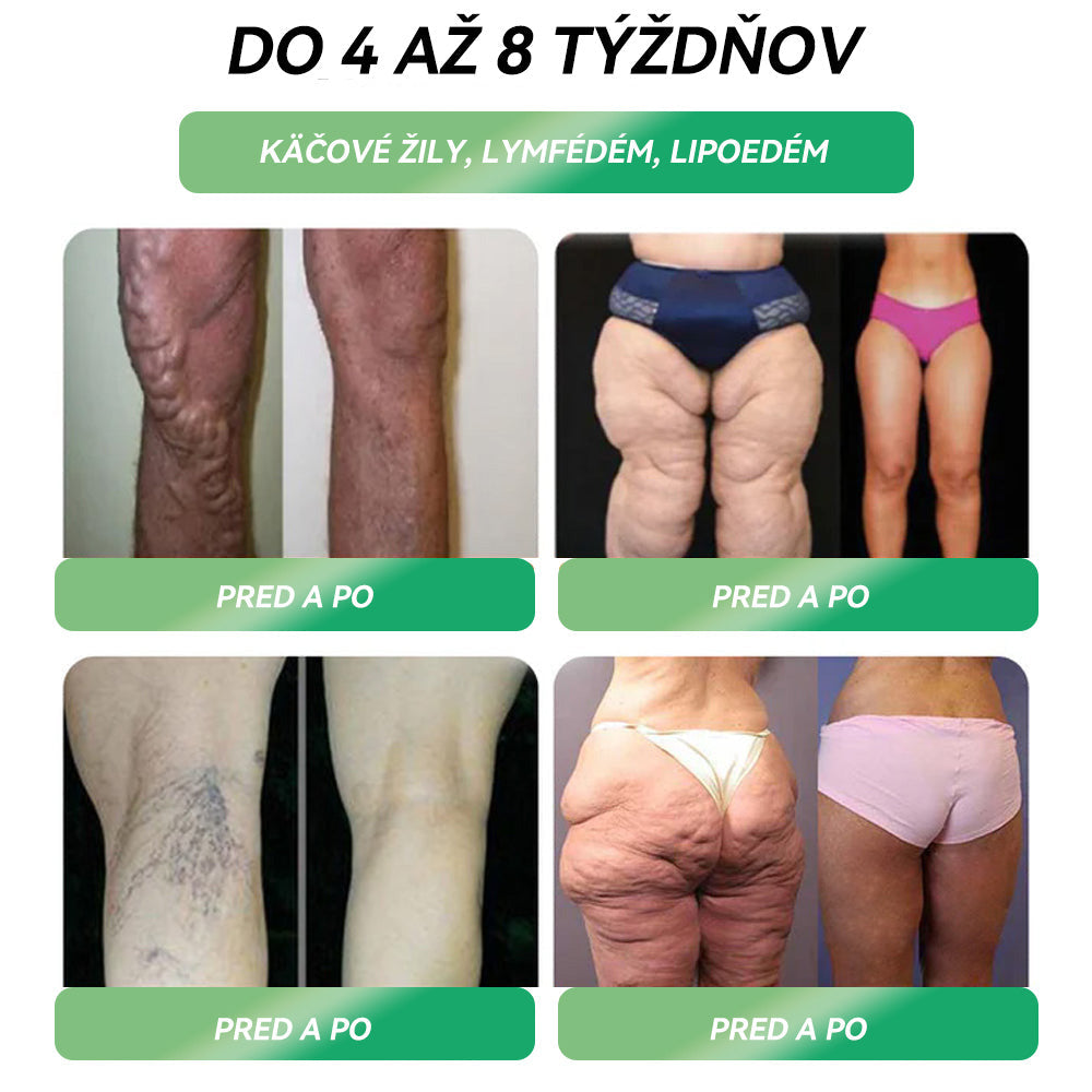 🏥𝐎𝐝𝐩𝐨𝐫úč𝐚𝐧é 𝐤𝐥𝐢𝐧𝐢𝐤𝐲 𝐋𝐞𝐤á𝐫𝐬𝐤𝐞𝐣 𝐟𝐚𝐤𝐮𝐥𝐭𝐲 𝐔𝐏𝐉Š 𝐯 𝐊𝐨š𝐢𝐜𝐢𝐚𝐜𝐡 | 𝗢𝗳𝗶𝗰𝗶á𝗹𝗻𝘆 𝗼𝗯𝗰𝗵𝗼𝗱 | 🍀𝐒𝐓𝐃𝗘𝗜® 𝐆𝐋𝐏-𝟏 𝐜𝐡𝐮𝐝𝐧𝐮𝐭𝐢𝐞 𝐩𝐞𝐫𝐨𝐫á𝐥𝐧𝐲 𝐫𝐨𝐳𝐭𝐨𝐤 -👨⚕️𝑶𝒃𝒆𝒛𝒊𝒕𝒂, 𝒌𝒂𝒓𝒅𝒊𝒐𝒗𝒂𝒔𝒌𝒖𝒍á𝒓𝒏𝒆 𝒐𝒄𝒉𝒐𝒓𝒆𝒏𝒊𝒂, 𝒄𝒖𝒌𝒓𝒐𝒗𝒌𝒂, 𝒔𝒑á𝒏𝒌𝒐𝒗é 𝒅ý𝒄𝒉𝒂𝒏𝒊𝒆, 𝒑𝒓𝒐𝒃𝒍é𝒎𝒚 𝒔 𝒌ĺ𝒃𝒎𝒊 𝒂 ď𝒂𝒍š𝒊𝒆