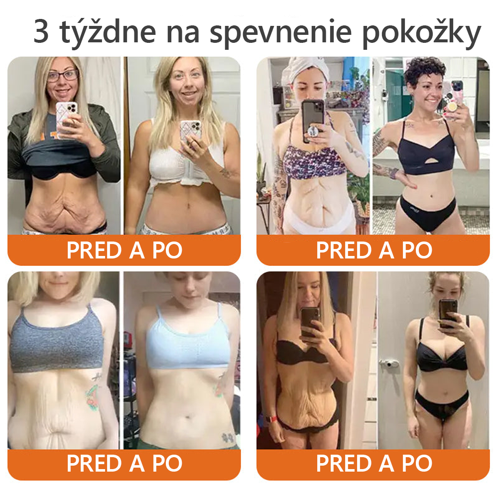 𝐕𝐲𝐫𝐨𝐛𝐞𝐧é 𝐚 𝐨𝐝𝐨𝐬𝐥𝐚𝐧é 𝐳𝐨 𝐒𝐥𝐨𝐯𝐞𝐧𝐬𝐤𝐚🍃𝗗𝗼𝗿𝗺𝗼𝐫𝐧𝐚® 𝗩č𝗲𝗹í 𝗝𝗲𝗱 𝗸𝗼𝗺𝗽𝗹𝗲𝘁𝗻ý 𝗸𝗿é𝗺🌟𝑷𝑶𝑺𝑳𝑬𝑫𝑵Ý 𝑫𝑬Ň 𝒁Ľ𝑨𝑽𝑨 80 %🔥🔥