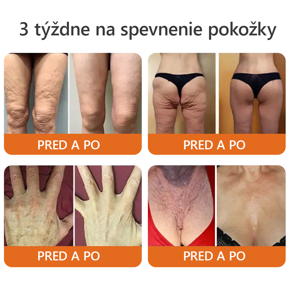 𝐕𝐲𝐫𝐨𝐛𝐞𝐧é 𝐚 𝐨𝐝𝐨𝐬𝐥𝐚𝐧é 𝐳𝐨 𝐒𝐥𝐨𝐯𝐞𝐧𝐬𝐤𝐚🍃𝗗𝗼𝗿𝗺𝗼𝐫𝐧𝐚® 𝗩č𝗲𝗹í 𝗝𝗲𝗱 𝗸𝗼𝗺𝗽𝗹𝗲𝘁𝗻ý 𝗸𝗿é𝗺🌟𝑷𝑶𝑺𝑳𝑬𝑫𝑵Ý 𝑫𝑬Ň 𝒁Ľ𝑨𝑽𝑨 80 %🔥🔥